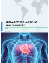 Angina Pectoris - A Pipeline Analysis Report