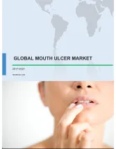 Global Mouth Ulcer Market 2017-2021