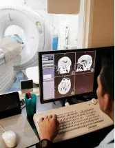 Intraoperative Neuromonitoring Market Analysis US - Size and Forecast 2024-2028