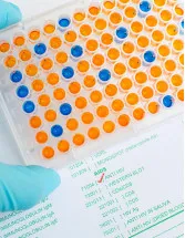 Enzyme-Linked Immunosorbent Assay (ELISA) Market Analysis North America, Europe, Asia, Rest of World (ROW) - US, UK, China, Germany, Japan - Size and Forecast 2024-2028