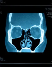 Sinus Dilation Devices Market Analysis North America, Europe, Asia, Rest of World (ROW) - US, Germany, Japan, Canada, UK - Size and Forecast 2024-2028