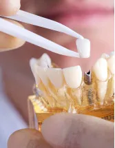 Dental Implants Market Analysis Europe, North America, Asia, Rest of World (ROW) - US, Germany, China, Japan, France - Size and Forecast 2024-2028