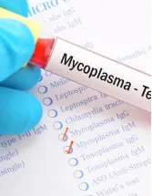 Mycoplasma Testing Market Analysis North America, Europe, Asia, Rest of World (ROW) - US, UK, Canada, Germany, China - Size and Forecast 2024-2028