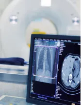 Medical Imaging Market Analysis North America, Europe, Asia, Rest of World (ROW) - US, Germany, Japan, France, UK - Size and Forecast 2024-2028