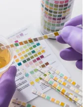 Urinalysis Market Analysis North America, Europe, Asia, Rest of World (ROW) - US, Germany, UK, China, Japan - Size and Forecast 2024-2028