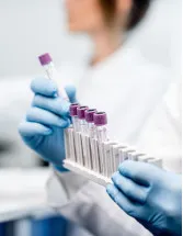 Protein Expression Market Analysis North America, Europe, Asia, Rest of World (ROW) - US, UK, China, Germany, Japan - Size and Forecast 2024-2028