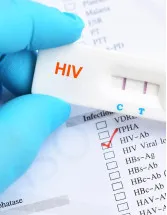 Human Immunodeficiency Virus (HIV) Rapid Test Kits Market Analysis North America, Europe, Asia, Rest of World (ROW) - US, Canada, China, UK, Japan, India, Germany, France, South Korea, Italy - Size and Forecast 2025-2029