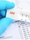 Human Immunodeficiency Virus (HIV) Rapid Test Kits Market Analysis North America, Europe, Asia, Rest of World (ROW) - US, Canada, UK, Germany, China - Size and Forecast 2024-2028