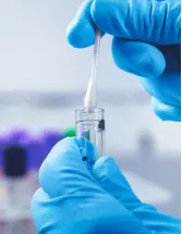 POC Molecular Diagnostics Market Analysis North America, Europe, Asia, Rest of World (ROW) - US, Germany, Canada, France, China - Size and Forecast 2024-2028