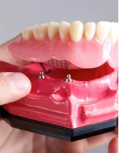 Dentures Market Analysis North America, Europe, Asia, Rest of World (ROW) - US, Germany, China, UK, Japan - Size and Forecast 2024-2028