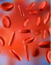 Immunohematology Market Analysis North America, Europe, Asia, Rest of World (ROW) - US, Germany, UK, Canada, China - Size and Forecast 2024-2028