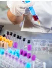 Clinical Laboratory Services Market Analysis North America, Europe, Asia, Rest of World (ROW) - US, UK, China, Germany, Japan - Size and Forecast 2024-2028