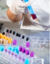 Clinical Laboratory Services Market Analysis North America, Europe, Asia, Rest of World (ROW) - US, UK, China, Germany, Japan - Size and Forecast 2024-2028