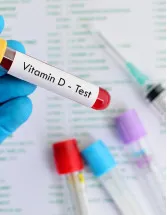 Vitamin D Testing Market Analysis North America, Europe, Asia, Rest of World (ROW) - US, Germany, China, UK, Canada - Size and Forecast 2024-2028