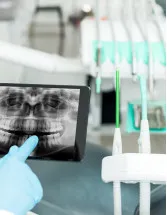 Dental Radiology Equipment Market Analysis North America, Europe, Asia, Rest of World (ROW) - US, Germany, China, France, Japan - Size and Forecast 2024-2028