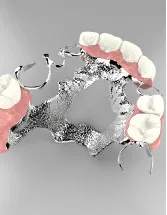 Dental Adhesives Market Analysis Europe, North America, Asia, Rest of World (ROW) - US, China, Germany, France, Canada - Size and Forecast 2024-2028