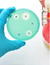 Methicillin-Resistant Staphylococcus Aureus (MRSA) Testing Market Analysis North America, Europe, Asia, Rest of World (ROW) - US, Germany, UK, Japan, Canada - Size and Forecast 2024-2028