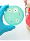 Methicillin-Resistant Staphylococcus Aureus (Mrsa) Testing Market Analysis North America, Europe, Asia, Rest of World (ROW) - US, Germany, UK, Japan, Canada - Size and Forecast 2024-2028