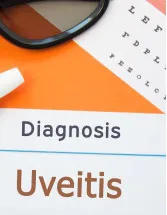 Uveitis Drugs Market Analysis North America, Europe, Asia, Rest of World (ROW) - US, Germany, UK, Canada, China - Size and Forecast 2024-2028