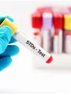 Sexually Transmitted Disease (STD) Testing Market Analysis North America, Europe, Asia, Rest of World (ROW) - US, Germany, UK, Canada, China - Size and Forecast 2024-2028