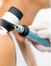 Dermatology Diagnostic Devices Market Analysis North America, Europe, Asia, Rest of World (ROW) - US, China, UK, Germany, Japan - Size and Forecast 2024-2028