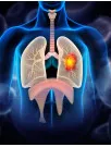 Lung Cancer Therapeutics Market Analysis North America, Europe, Asia, Rest of World (ROW) - US, UK, Canada, China, Japan, France, Germany, India, Spain, South Korea - Size and Forecast 2025-2029