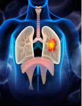 Lung Cancer Therapeutics Market Analysis North America, Europe, Asia, Rest of World (ROW) - US, UK, Canada, China, Japan, France, Germany, India, Spain, South Korea - Size and Forecast 2025-2029