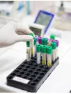 In-vitro Diagnostics (IVD) Market Analysis North America, Europe, Asia, Rest of World (ROW) - US, Canada, Germany, China, Japan - Size and Forecast 2024-2028