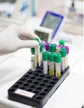 In-Vitro Diagnostics (IVD) Market Analysis North America, Europe, Asia, Rest of World (ROW) - US, Germany, Canada, China, Japan, UK, France, India, Italy, Brazil - Size and Forecast 2025-2029