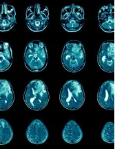 Glioblastoma Multiforme Treatment Market Analysis North America, Europe, Asia, Rest of World (ROW) - US, Germany, Canada, China, UK - Size and Forecast 2024-2028