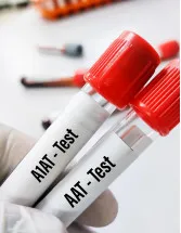 Immunology Market Analysis North America, Europe, Asia, Rest of World (ROW) - US, Germany, UK, China, Japan - Size and Forecast 2024-2028