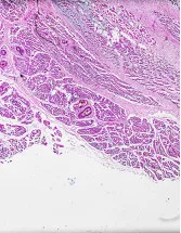 Bone Biopsy Market Analysis North America, Europe, Asia, Rest of World (ROW) - US, Germany, China, France, Japan - Size and Forecast 2024-2028