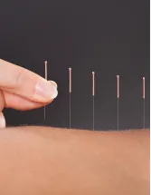 Acupuncture Market Analysis Europe, North America, Asia, Rest of World (ROW) - US, France, Italy, China, Japan - Size and Forecast 2024-2028