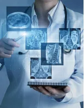 Europe Diagnostic Imaging Market Analysis - Size and Forecast 2024-2028