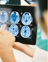 Brain Tumor Diagnostics Market Analysis North America, Europe, Asia, Rest of World (ROW) - US, Germany, UK, China, Japan, France, Canada, Mexico, India, South Africa - Size and Forecast 2024-2028