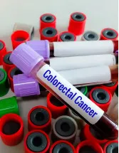 Colorectal Cancer Therapeutics Market Analysis North America, Europe, Asia, Rest of World (ROW) - US, Germany, UK, Canada, China - Size and Forecast 2024-2028