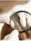 Lice Treatment Market Analysis North America, Europe, Asia, Rest of World (ROW) - US, Canada, China, Germany, Japan, UK, India, France, Italy, South Korea - Size and Forecast 2024-2028