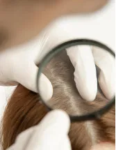 Lice Treatment Market Analysis North America, Europe, Asia, Rest of World (ROW) - US, Canada, China, Germany, Japan, UK, India, France, Italy, South Korea - Size and Forecast 2024-2028