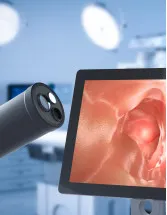 Endoscopy Devices Market in South Africa by Product and End-user - Forecast and Analysis 2022-2026
