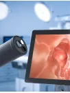 South Africa Endoscopy Devices Market Analysis - Size and Forecast 2024-2028