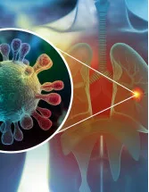 Bronchitis Treatment Market Analysis North America, Europe, Asia, Rest of World (ROW) - US, Canada, Germany, Australia, New Zealand - Size and Forecast 2024-2028