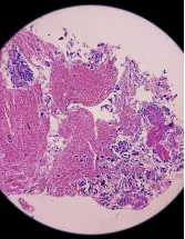 Sarcoma Therapeutics Market Analysis North America, Europe, Asia, Rest of World (ROW) - US, China, Germany, Canada, UK - Size and Forecast 2024-2028