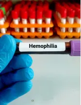 Rare Hemophilia Factors Market Analysis North America, Europe, Asia, Rest of World (ROW) - US, Germany, UK, Canada, Japan - Size and Forecast 2024-2028