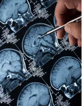 Neurovascular Devices Market Analysis North America, Europe, Asia, Rest of World (ROW) - US, Denmark, China, Canada, India - Size and Forecast 2024-2028