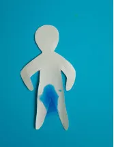 Urinary Incontinence Devices Market Analysis North America, Europe, Asia, Rest of World (ROW) - US, Germany, UK, Canada, China, France, Japan, Italy, India, Spain - Size and Forecast 2024-2028