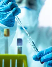 Arbovirus Testing Market Analysis North America, Europe, Asia, Rest of World (ROW) - US, Germany, UK, China, Canada - Size and Forecast 2024-2028