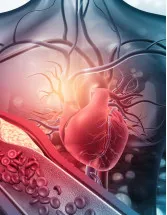 Atherosclerosis Therapeutics Market Analysis North America, Europe, Asia, Rest of World (ROW) - US, Canada, UK, China, Germany - Size and Forecast 2024-2028