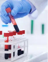 Blood Collection Tubes Market Analysis North America, Europe, Asia, Rest of World (ROW) - US, Canada, Germany, China, UK, France, Japan, India, Italy, South Korea - Size and Forecast 2024-2028