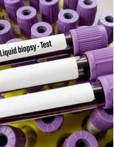 Breast Cancer Liquid Biopsy Market Analysis North America, Europe, Asia, Rest of World (ROW) - US, Germany, Canada, UK, France - Size and Forecast 2024-2028