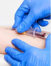 Venous Blood Collection Market Analysis North America, Asia, Europe, Rest of World (ROW) - US, China, India, Canada, Germany - Size and Forecast 2024-2028